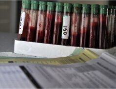 Tuberculosis tests