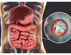 Farmyard germs cryptosporidiosis